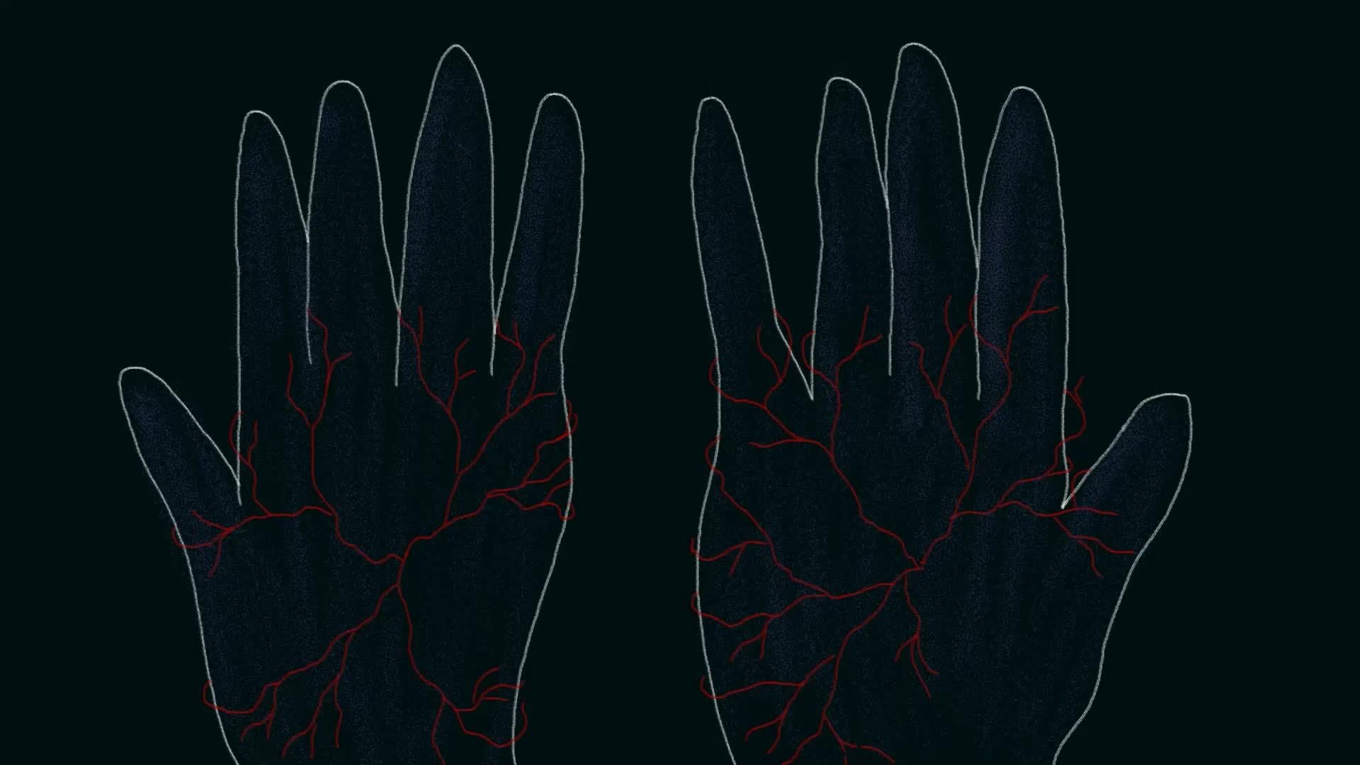 Veins of Anxiety