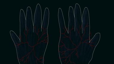 Veins of Anxiety