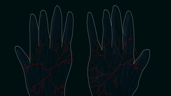 Veins of Anxiety